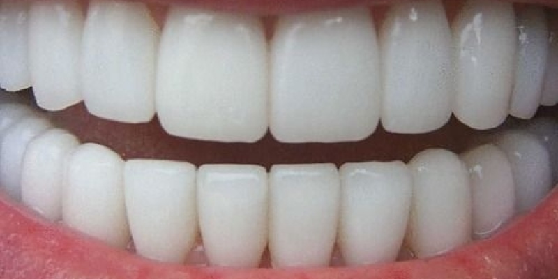 3 DAKİKADA DOĞAL BEYAZ DİŞLERE NASIL SAHİP OLUNUR?